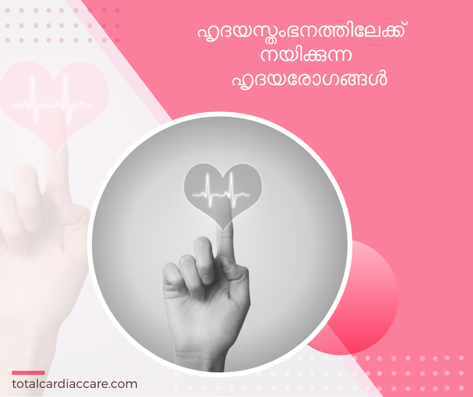 ഹൃദയസ്തംഭനത്തിലേക്ക് നയിക്കുന്ന ഹൃദയരോഗങ്ങള്‍ - Total Cardiac Care 