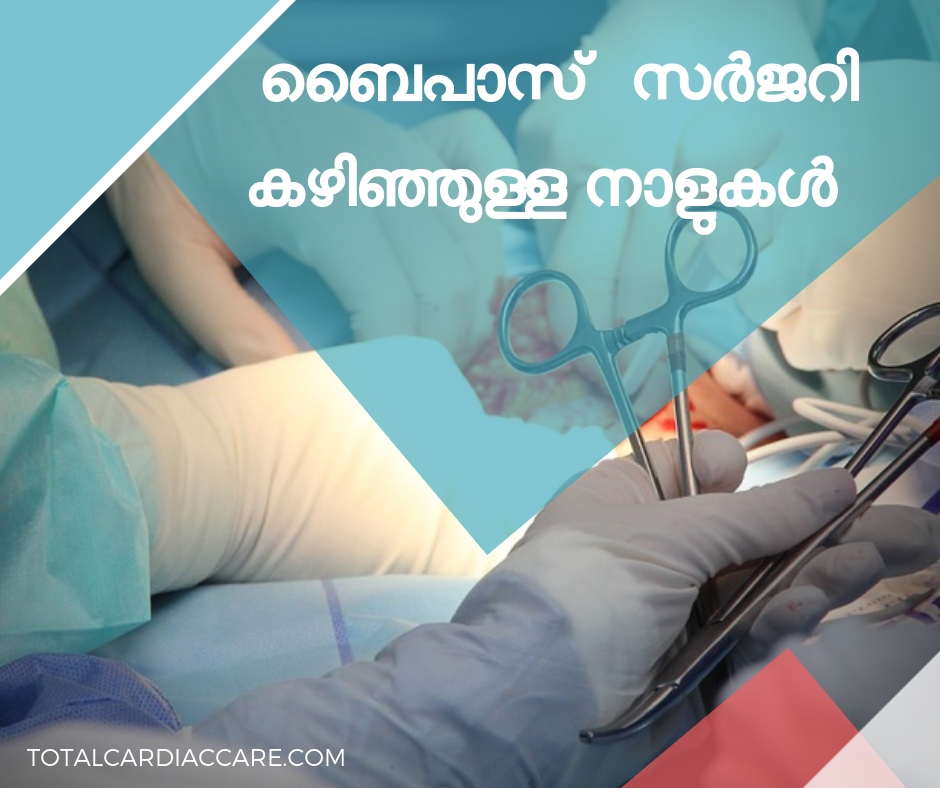 ബൈപാസ് സർജറി കഴിഞ്ഞുള്ള നാളുകൾ - Total Cardiac Care