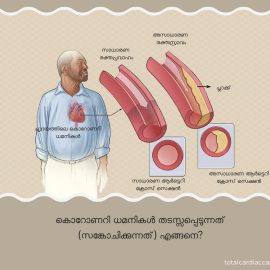 ‘ബൈപാസ് സർജറി’ യെക്കുറിച്ച് നിങ്ങൾ കേട്ടിരിക്കണം, എന്നാൽ ഈ സർജറി എന്തുകൊണ്ടാണെന്ന് ചെയ്യുന്നത് എന്ന് അറിയാമോ? – Total Cardiac Care | Dr Mahadevan Ramachandran