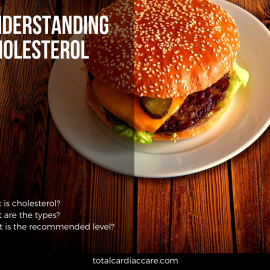 Understanding cholesterol – Total Cardiac Care