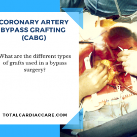 Types of Bypass Grafts Types of Bypass Grafts