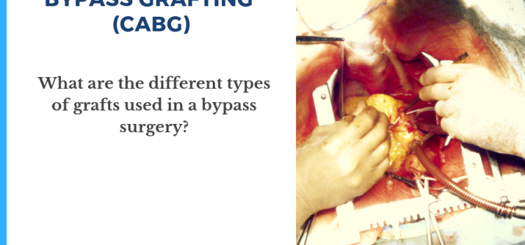 Types of Bypass Grafts
