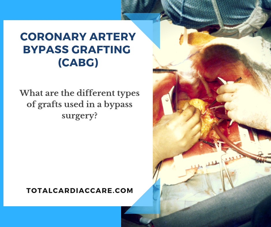 Coronary Artery Bypass Grafting (CABG) -bypass grafts - What are the different types of grafts used in a bypass surgery? - Total cardiac Care.