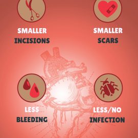 BENEFITS OF KEYHOLE SURGERIES | Total Cardiac Care | Dr. Mahadevan