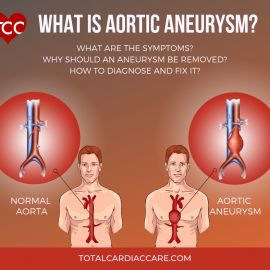 What is Aortic Aneurysm? | Total Cardiac Care