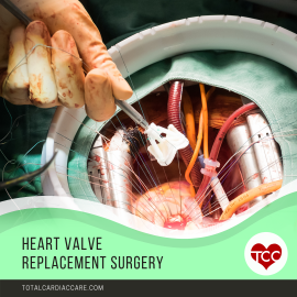 Heart Valve Replacement Surgery | Total Cardiac Care by Dr. Mahadevan